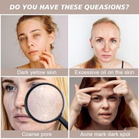 LOPHE Sérum Visage, 10% Niacinamide and 1% Zinc Blemish & Pore Sérum,Anti-rides, Anti-taches, Anti-âge et Hydratant,Power Fac...