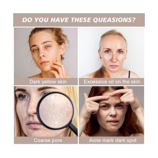 LOPHE Sérum Visage, 10% Niacinamide and 1% Zinc Blemish & Pore Sérum,Anti-rides, Anti-taches, Anti-âge et Hydratant,Power Fac...