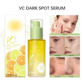 Green Tangerine Sérum à la vitamine C Dark Spot Sérum, sérum anti-taches sombres et sérum éclaircissant, sérum à la vitamine ...