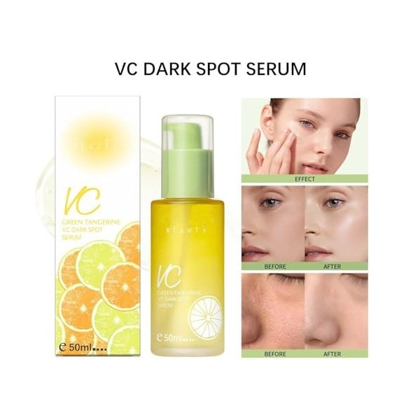 Green Tangerine Sérum à la vitamine C Dark Spot Sérum, sérum anti-taches sombres et sérum éclaircissant, sérum à la vitamine ...
