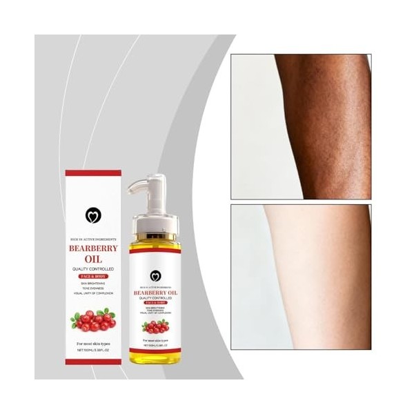 Huile De Busserole Eclaircissante,Alpha Arbutin Huile Eclaircissante Peau Noire,Dark Spot Correcting Glow Serum,Huiles De Bus...