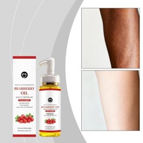 Huile De Busserole Eclaircissante,Alpha Arbutin Huile Eclaircissante Peau Noire,Dark Spot Correcting Glow Serum,Huiles De Bus