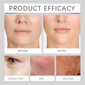 30g Crème Anti-Âge Liftant Instantané, Soin Raffermissant Rides et Ridules, Traitement Tenseur pour Visage et Cou, Crème Anti...