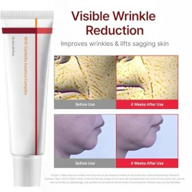 DOVBAN Crème Avancée à Absorption Rapide Et Nourrissante,Hydrate,Raffermit Et Réduit Les Rides,Faible Irritation,Soin De La P