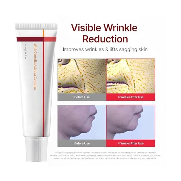 DOVBAN Crème Avancée à Absorption Rapide Et Nourrissante,Hydrate,Raffermit Et Réduit Les Rides,Faible Irritation,Soin De La P