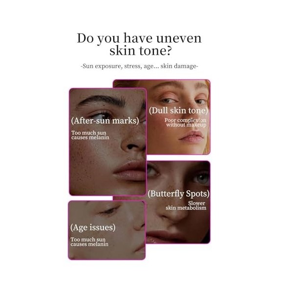 Alpha Arbutin 7 Tranexamic Acid 4 Cream, Creme Eclaircissante Peau Noir Puissant, Even out Tone, Creme Anti Tache Visage, Ant...