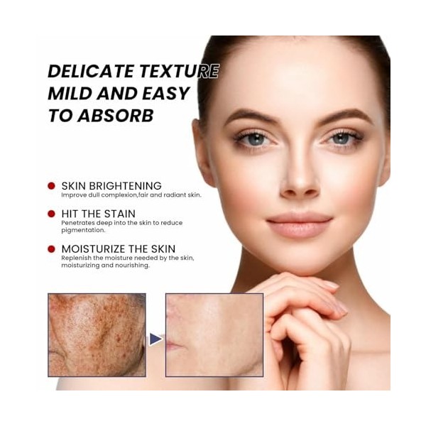 Creme Anti Taches Brunes Visage Coréenne,Creme Eclaircissante Peau Noir Puissant,Crème Anti Imperfection Visage,Faded Topical...