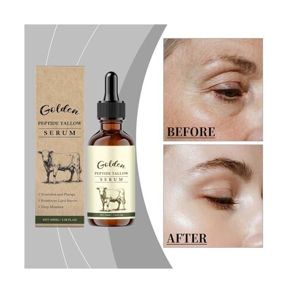 Sérum Hydratant Au Suif Pour Le Visage, 100ML Sérum Visage Raffermissant Anti-âge Au Suif, Hydratation Et Stimulation Du Coll...