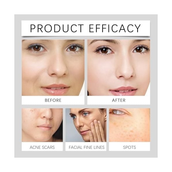 Essence pour le visage contre les taches de rousseur, élimine les taches brunes, antioxydante, illumine le teint, convient à ...