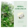 Crème Anti-Acné, Crème Visage Acné, Crèm Anti-Boutons Visage, Réduit Rapidement les Imperfections, Solution Ciblée Contre les