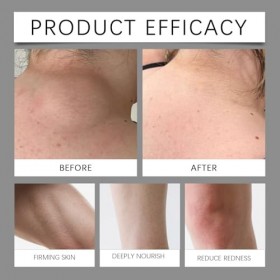 Lot de 2 crèmes régénérantes à double action - Crème hydratante naturelle pour éliminer les verrues et les excroissances de l