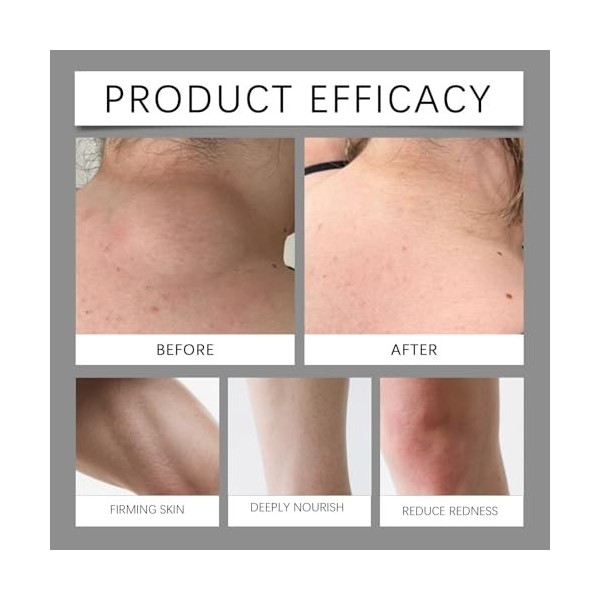 Lot de 2 crèmes régénérantes à double action - Crème hydratante naturelle pour éliminer les verrues et les excroissances de l