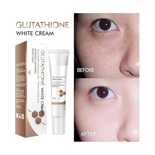 Glutathione Whitening Cream Facial Dark Spots Remover,Kojic Acid Glutathione Cream,Lightening Blemish Remover Creams,Face Moi...