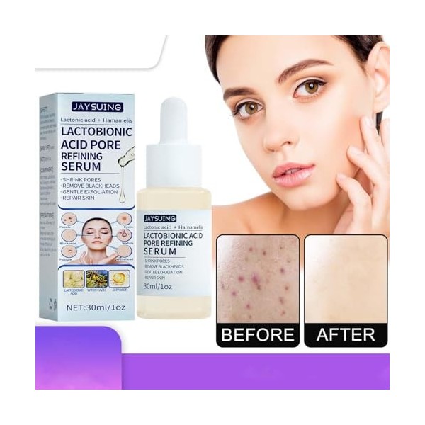 Acide lactobionique jeune - Acide lactobionique doux hydratant | 30 ml pour nettoyer en profondeur le visage, pores fins, hyd