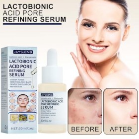 Jeune acide lactobionique - Huile dacide lactobionique douce pour le visage - 30m Face Oil Hydrate Replenish Care Peau déshy