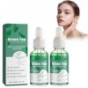 2PCS Essence Pour Sérums Et Fluides For Thé Vert, Essence Antioxydante pour le Visage, Sérum de Peau Claire au Thé Vert, Text