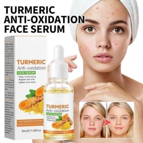 Sérum correcteur de taches brunes au curcuma, Sérum éclaircissant pour le visage, Lotion huileux au curcuma pour le visage, H...