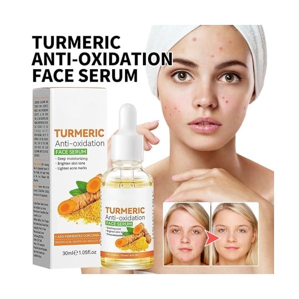 Sérum correcteur de taches brunes au curcuma, Sérum éclaircissant pour le visage, Lotion huileux au curcuma pour le visage, H...