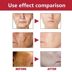 lmoikesz Visage Blanchiment Éclaircissant Sérum Filles Hydratant Hydratant Soins De La Peau Stock Solution Beauté Fournitures