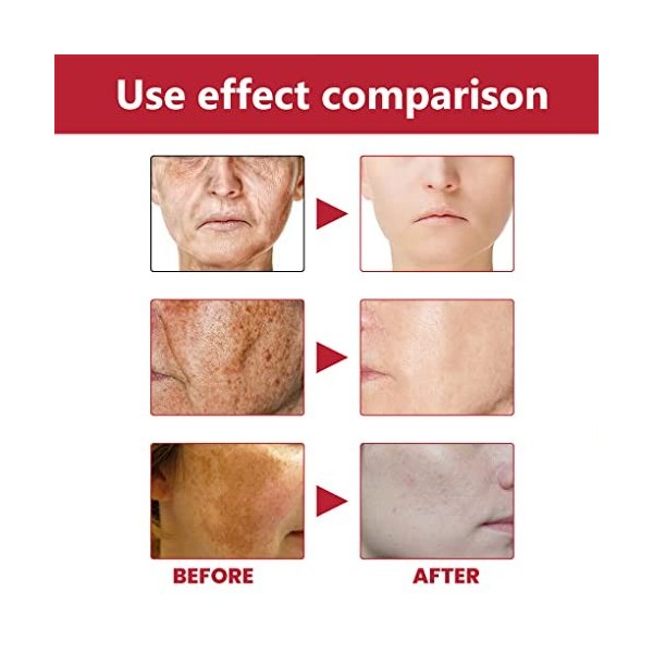 lmoikesz Visage Blanchiment Éclaircissant Sérum Filles Hydratant Hydratant Soins De La Peau Stock Solution Beauté Fournitures