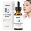 Serum Niacinamide, Niacinamide 10% + Zinc 1%, Serum Visage Anti Imperfection, Réduit Pores Dilatés Visage, Réduit le Teint Te