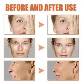 30ML Pedia Advanced Collagen Boost Anti Aging Serum, Collagen Boost Anti Aging Serum, Hyaluronic Acid with Brightening Vitami...