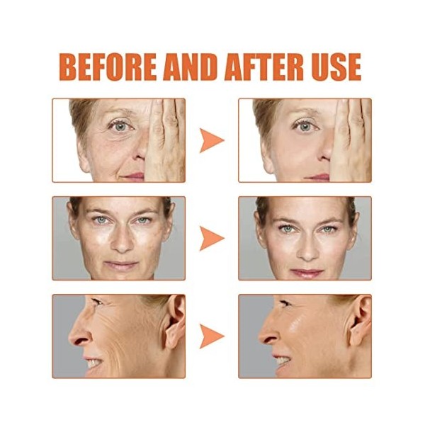 30ML Pedia Advanced Collagen Boost Anti Aging Serum, Collagen Boost Anti Aging Serum, Hyaluronic Acid with Brightening Vitami...