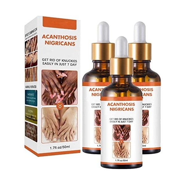 Acanthosis Nigricans Lot de 3 huiles thérapeutiques pour corriger les taches sombres, traitement de lacanthose nigricans, él ...