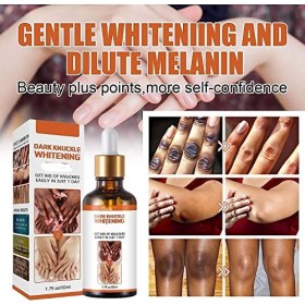 Acanthosis Nigricans Lot de 3 huiles thérapeutiques pour corriger les taches sombres, traitement de lacanthose nigricans, él ...