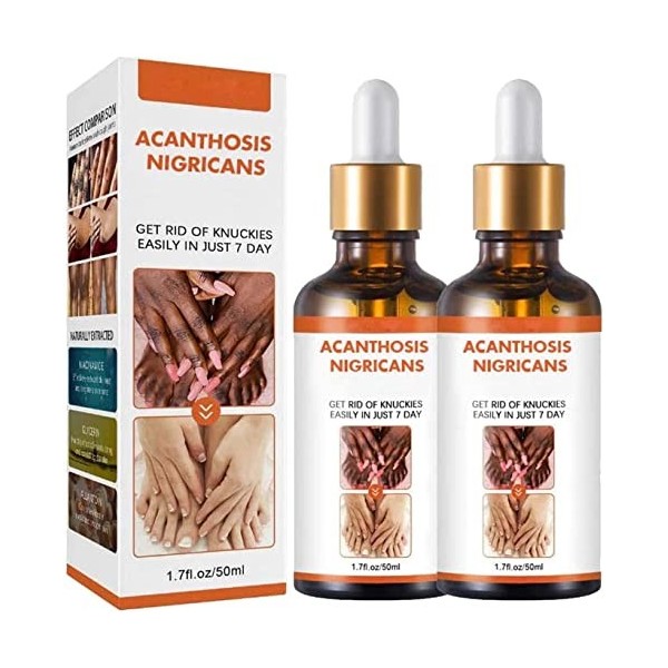 Acanthosis Nigricans Lot de 3 huiles thérapeutiques pour corriger les taches sombres, traitement de lacanthose nigricans, él ...