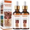 Acanthosis Nigricans Lot de 3 huiles thérapeutiques pour corriger les taches sombres, traitement de lacanthose nigricans, él ...