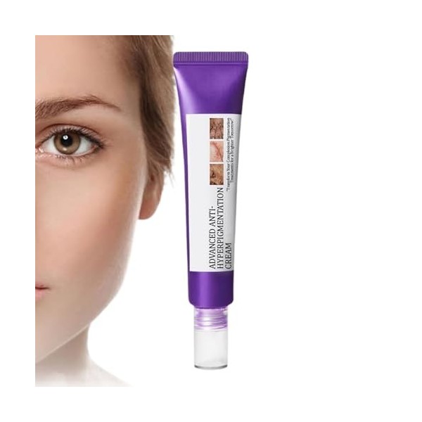 Crème Anti-Hyperpigmentation pour le Visage | Soin Visage Hydratant 20g,Lotion Hydratante, Produit pour lAtténuation des Imp