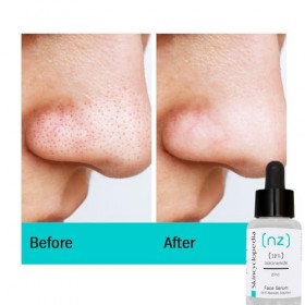 Skincyclopedia Sérum 10% Niacinamide – Traitement de lhyperpigmentation et des cicatrices dacné – Minimiseur de pores pour 