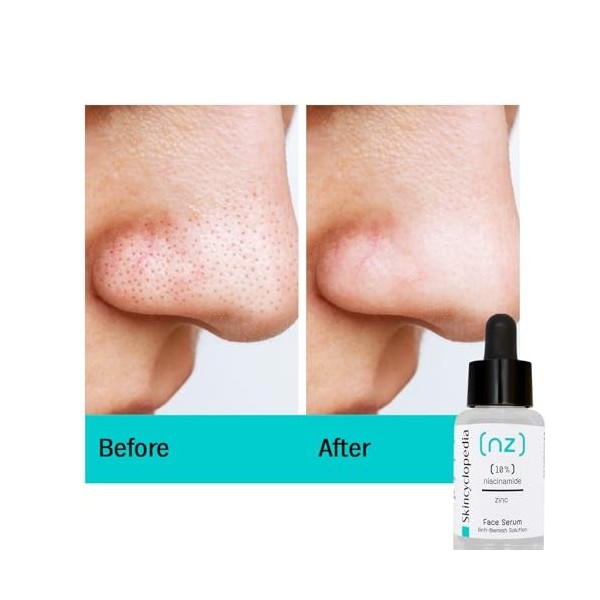Skincyclopedia Sérum 10% Niacinamide – Traitement de lhyperpigmentation et des cicatrices dacné – Minimiseur de pores pour 
