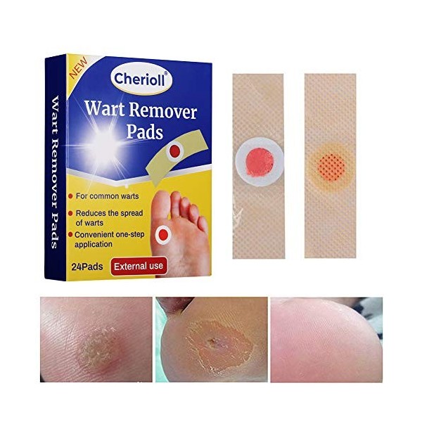 Witch Doctor 81.5% w/w GEL, Extract of Witch Hazel by Witch