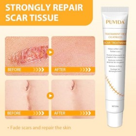 20g Crème pour Cicatrices,Crème de Soin pour la Peau,crème hydratante pour peaux irrégulières,Soin Réparateur,Texture légère,