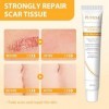 20g Crème pour Cicatrices,Crème de Soin pour la Peau,crème hydratante pour peaux irrégulières,Soin Réparateur,Texture légère,