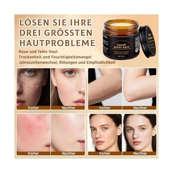 Crème au suif de bœuf, crème pour le visage et les mains, hydratation en profondeur et crème hydratante, suif de bœuf nourris