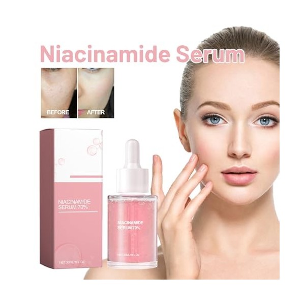 Niacinamide + Zinc Serum Visage Anti Imperfection, peau Sérum de niacinamide, Réduit Pores Dilatés Visage Niacinamide 70% Sér