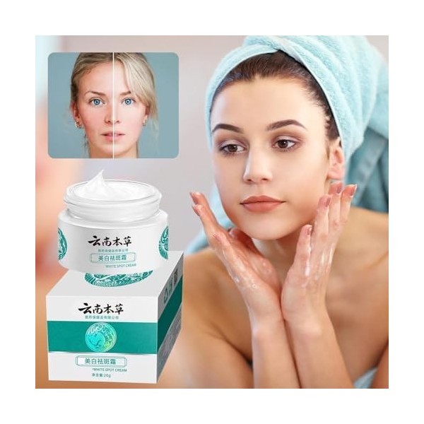 Crème Melasma Japonaise Et Serum Anti Tache Visage,Crème Anti-Taches Blanches Coréenne,Kits De Skin Care Coréenne,Anti Tache 