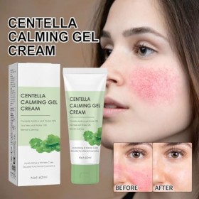 2 Pcs Centella Calming Gel Crème, Crème Hydratante Riche Con de la Centella Asiatica, Day&Night Cream,Soin Hydratant pour le 