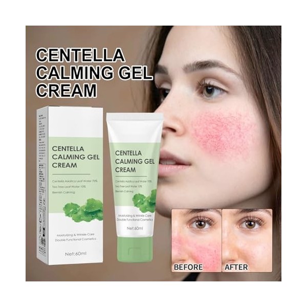 2 Pcs Centella Calming Gel Crème, Crème Hydratante Riche Con de la Centella Asiatica, Day&Night Cream,Soin Hydratant pour le