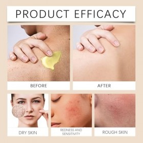 Crème complète au venin dabeille, crème complète au venin dabeille, crème régénérante pour tous les types de peau et lisse 