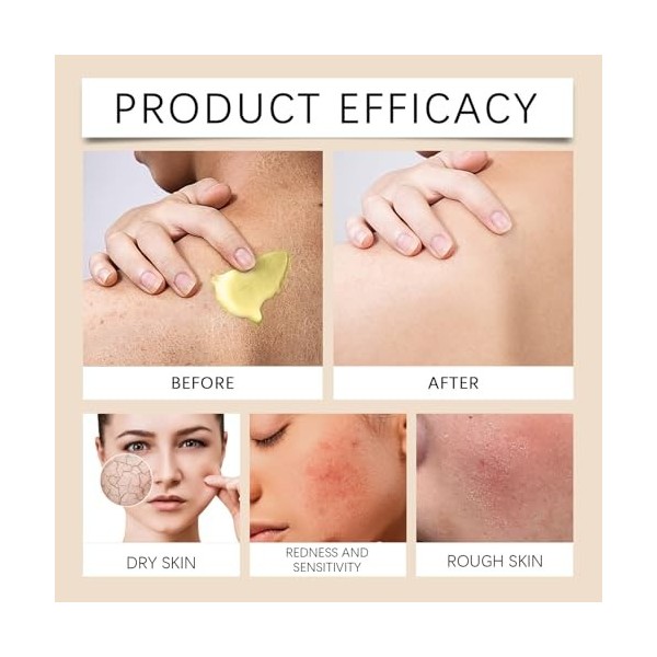 Crème complète au venin dabeille, crème complète au venin dabeille, crème régénérante pour tous les types de peau et lisse 