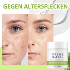 Pommade au cresson Plus - Contre les taches de vieillesse, les taches pigmentaires, les taches de rousseur, les taches sombre