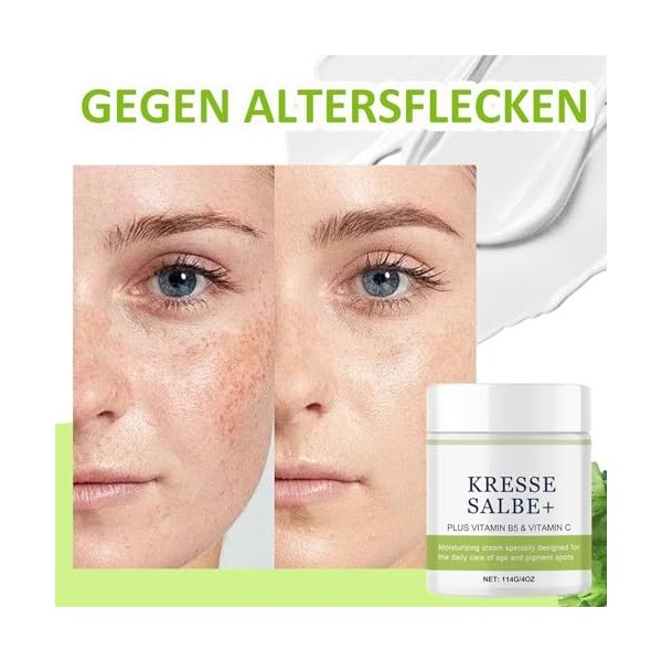 Pommade au cresson Plus - Contre les taches de vieillesse, les taches pigmentaires, les taches de rousseur, les taches sombre