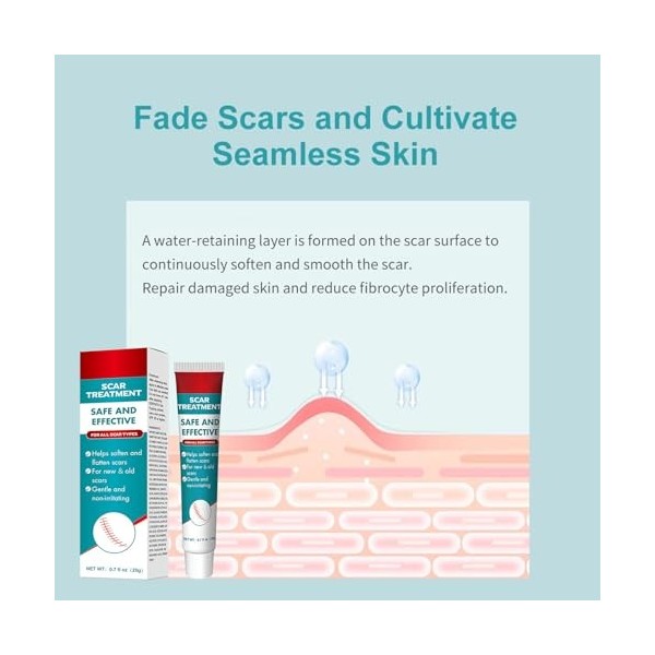 Crème Cicatrice, Crème Anti-Cicatrices, éclaircit Les Cicatrices, Réduit Visible Cicatrices à Partir, La Plupart Types De Cic