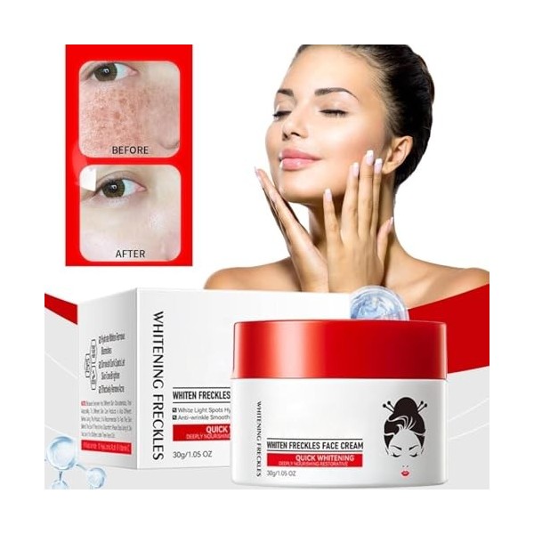 Creme Anti Tache Visage,Creme Eclaircissante Peau Noir Puissant,Anti Tache Brune Visage Efficace,Crèmes Pour Enlever Les Tach...