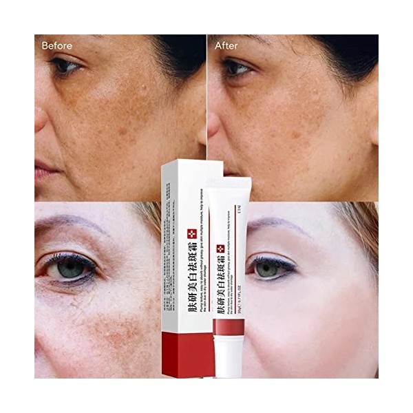 2PCS Spot-Off Freckle Whitening Cream,Blanchissante, Visage Anti Taches,Moisturizing Brightening Cream,Crème de traitement po