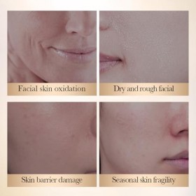 Hppsctink 30ml Essence de curcuma et 60g Crème pour le visage au curcuma, Nourrissant et légèrement hydratant, Crème éclairci